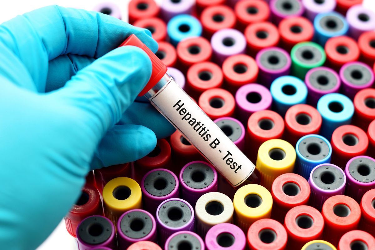   Hepatitis B Core, Total Antibody