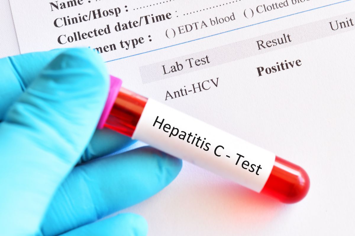   Hepatitis C Total Antibody