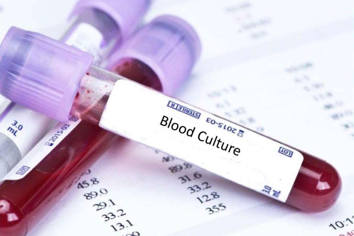   Blood Culture