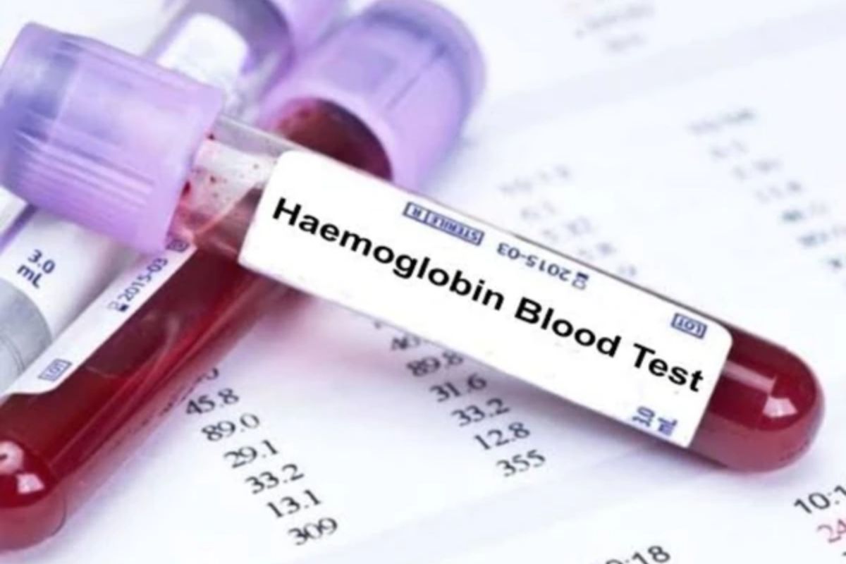   Haemoglobin (Hb)