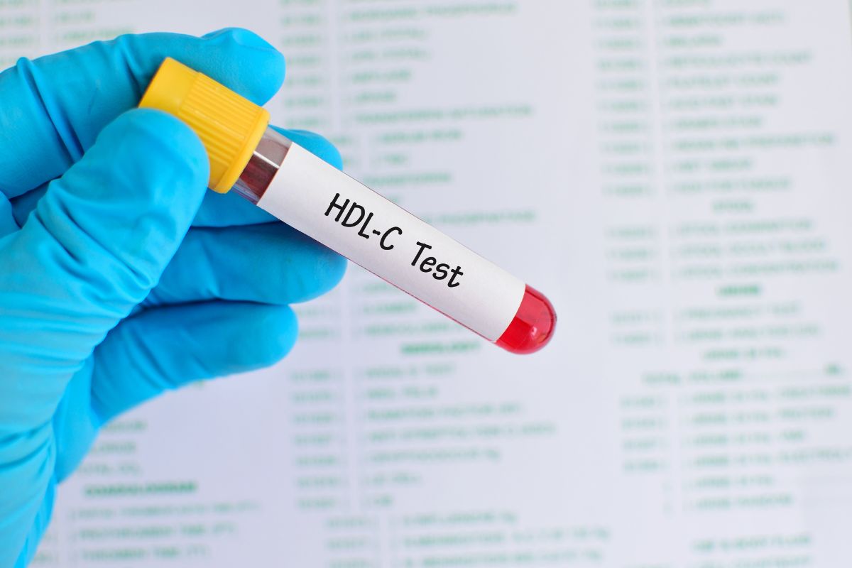   HDL - Cholesterol