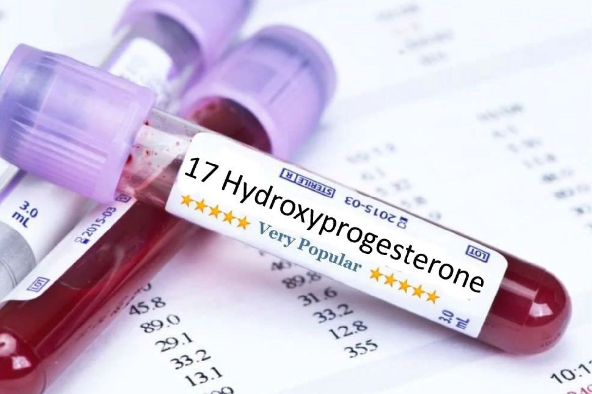   17 Alpha - Hydroxy Progesterone