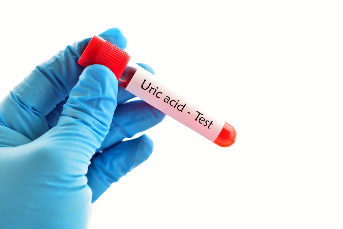   24 Hrs Urine - Uric Acid