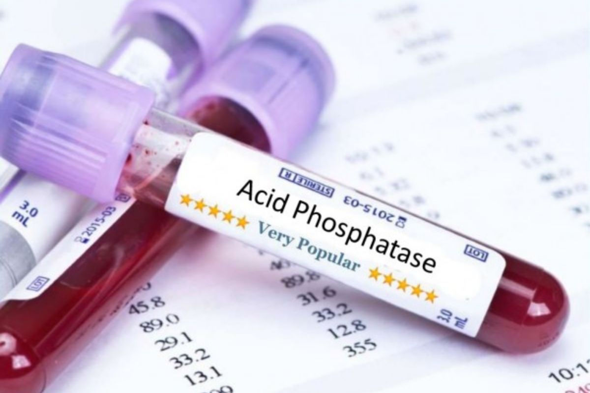   Acid Phosphatase-Total