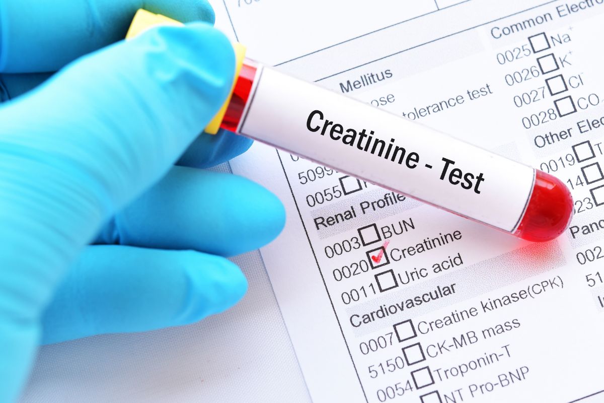   Albumin /Creatinine Ratio Spot Urine (ACR)