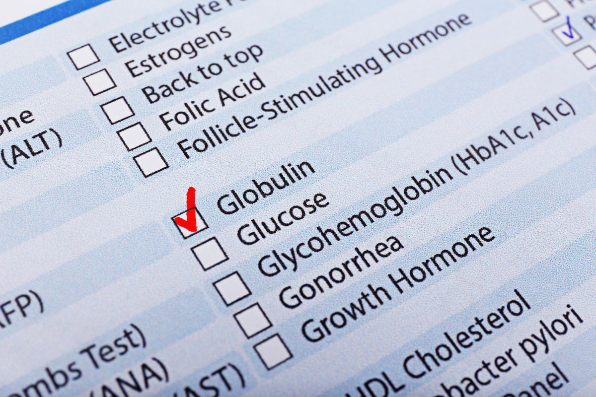   Albumin/Globulin Ratio ( A/G Ratio)