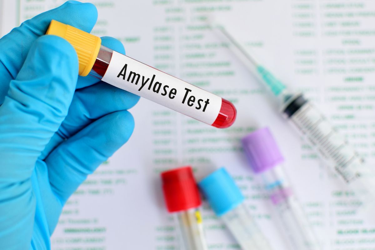   Amylase