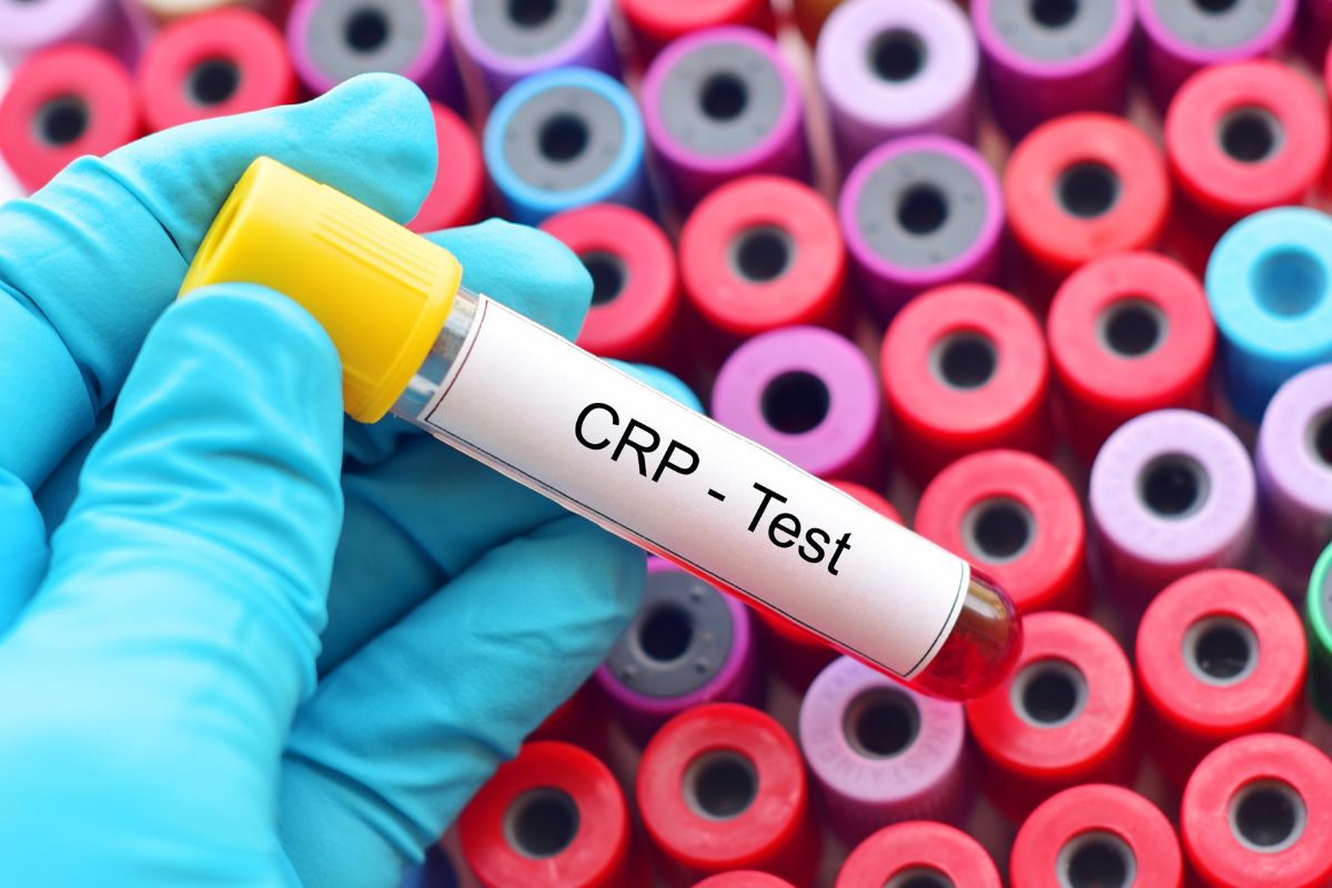   C-Reactive Protein Quantitative