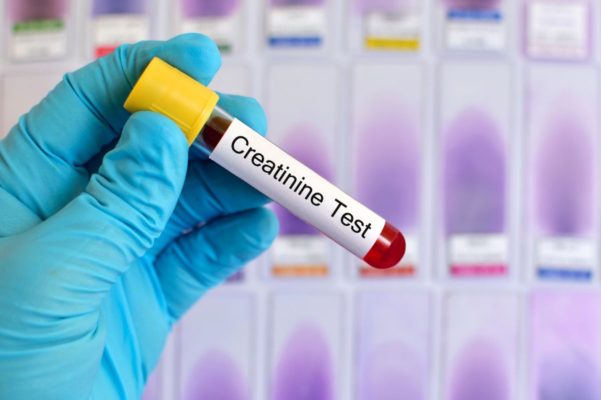   Creatinine