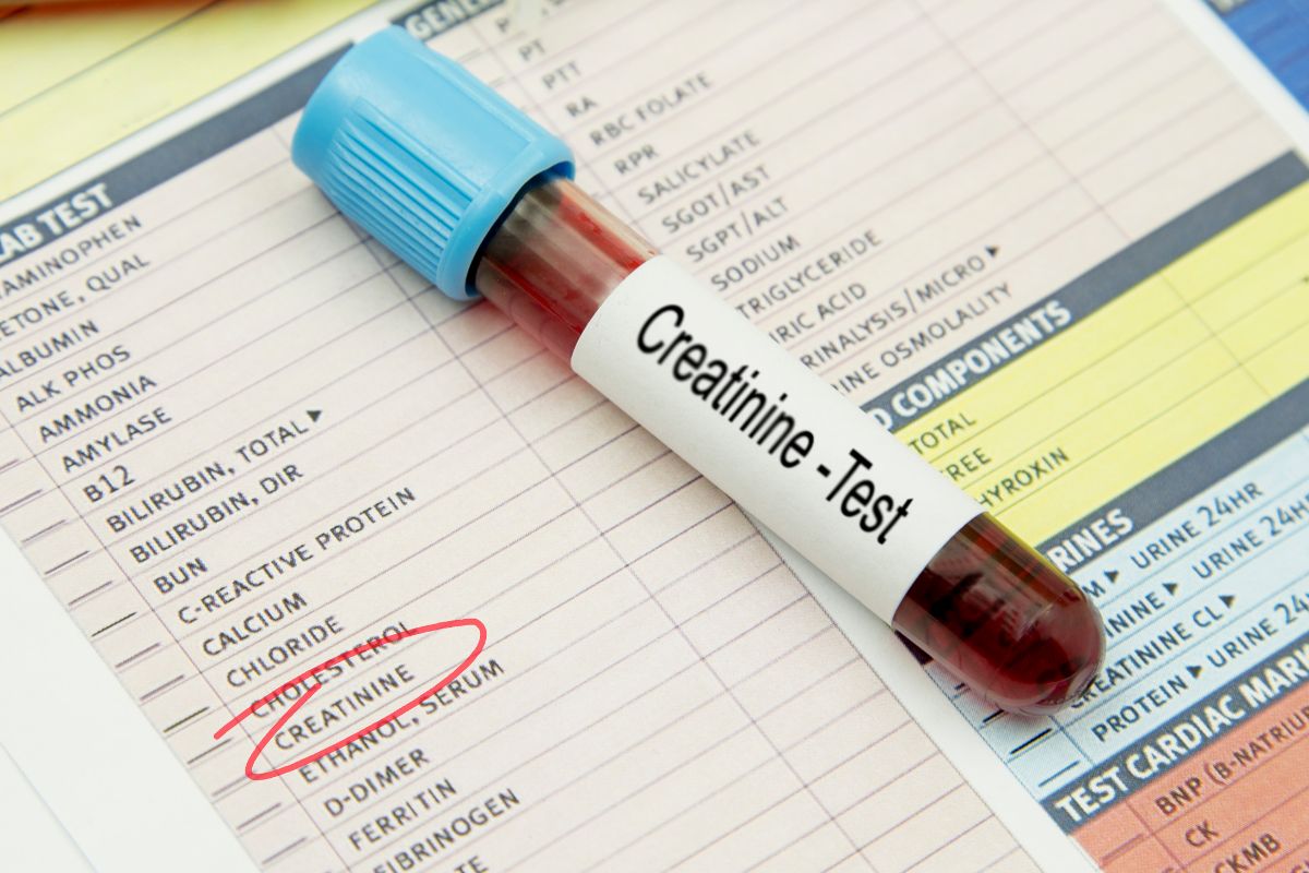   Creatinine Clearance Test