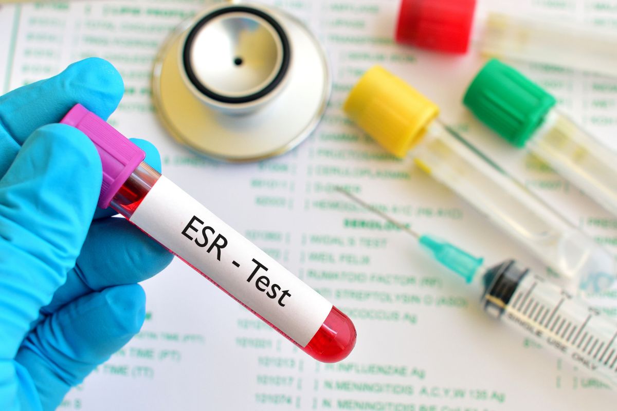   Erythrocyte Sedimentation Rate