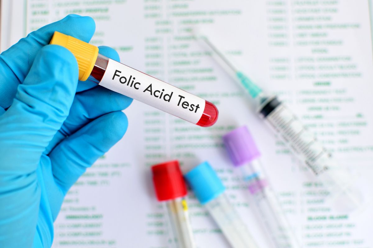   Folic Acid / Folate