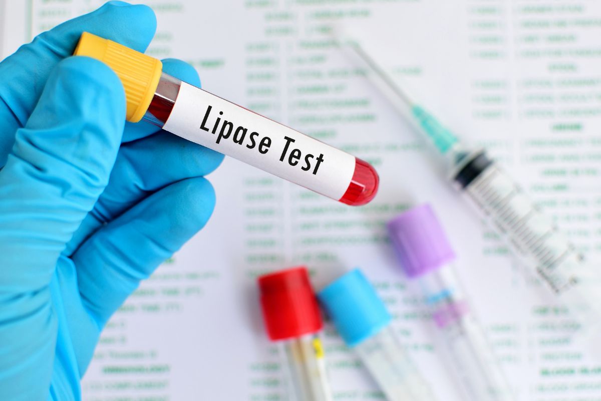   Lipase