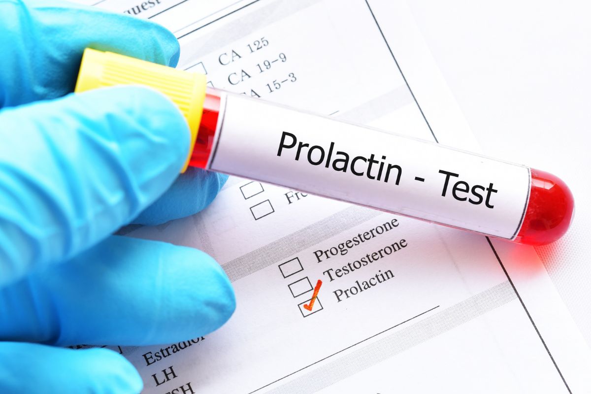   Prolactin (PRL)