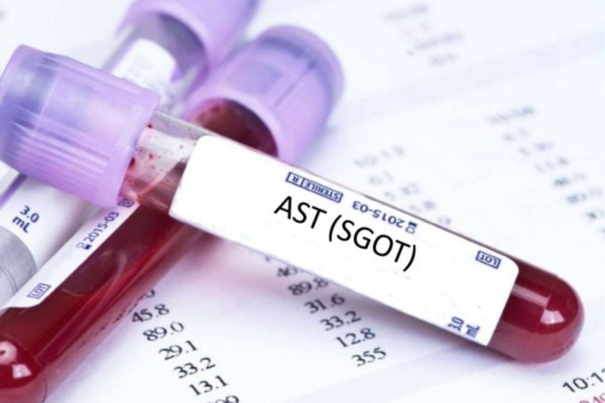   Aspartate Amino Transferase (SGOT-AST)