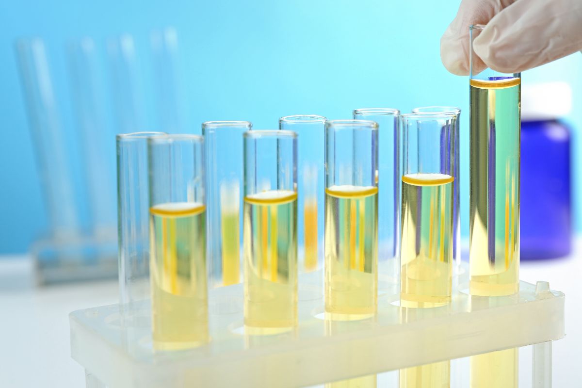   Spot Urinary Creatinine