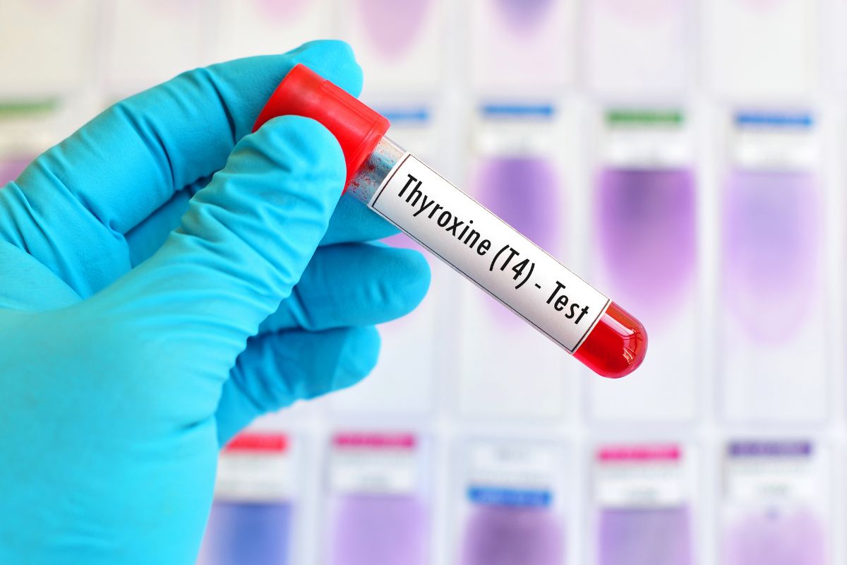   Total Thyroxine (T4), CLIA