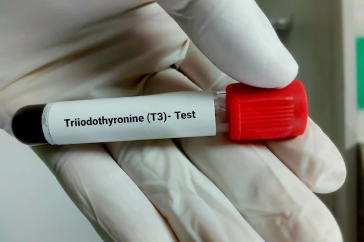   Total Triidothyronine (T3), CLIA