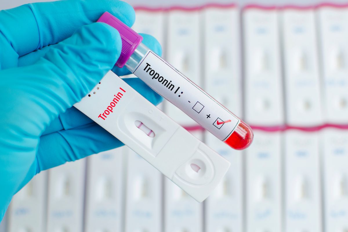   Troponin - I (Semi Quantitative)