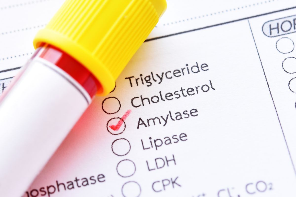   Urinary Amylase (24 HRS)