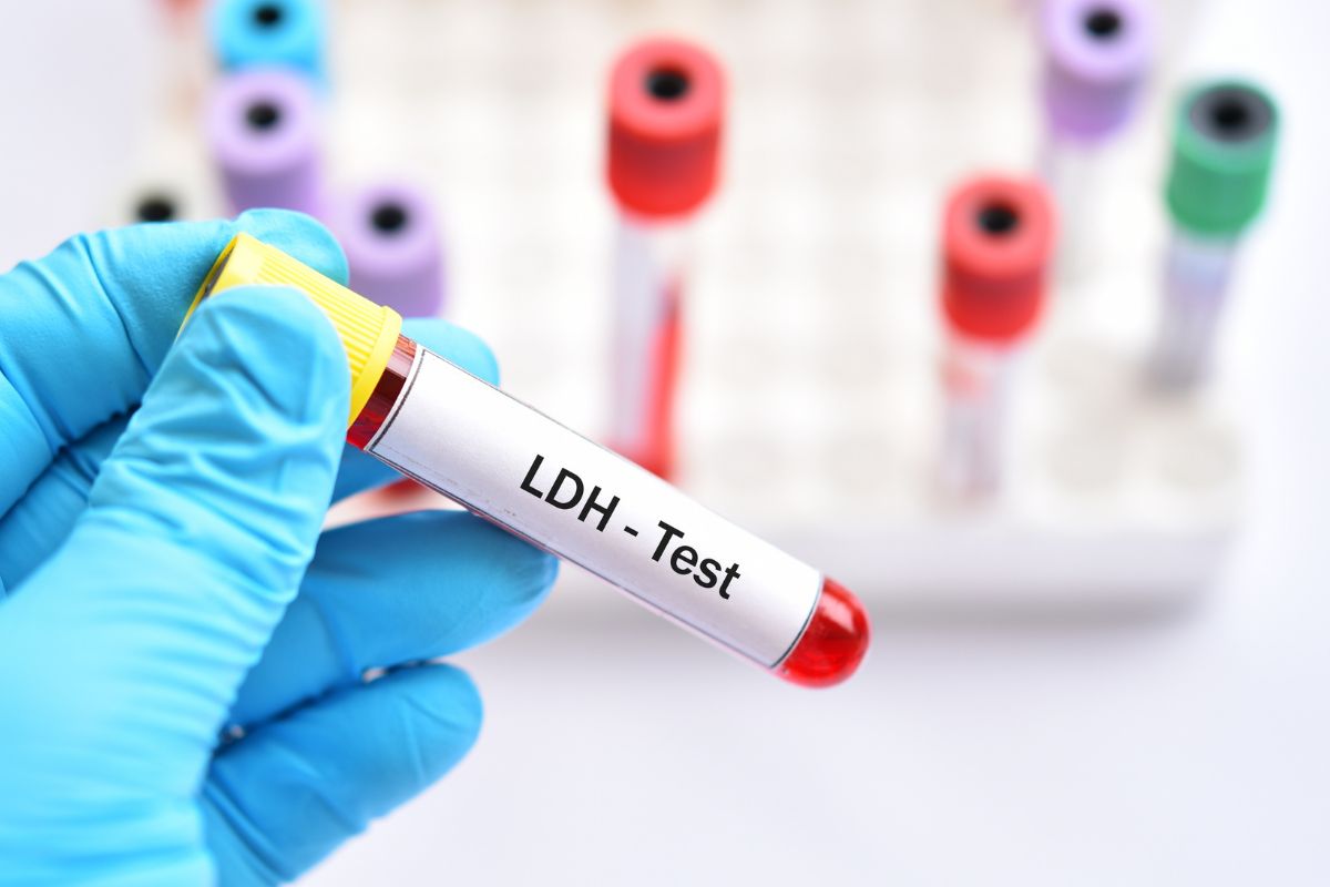 LDH (Lactate Dehydrogenase)