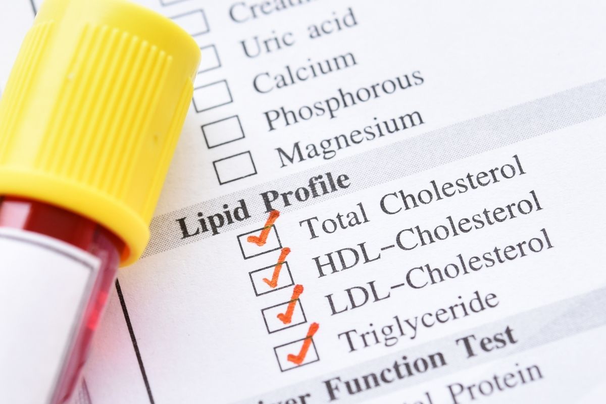 Lipid Profile Panel