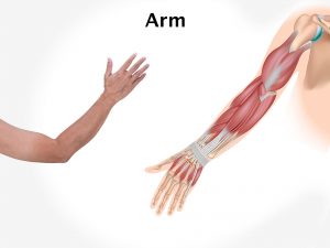 ARM