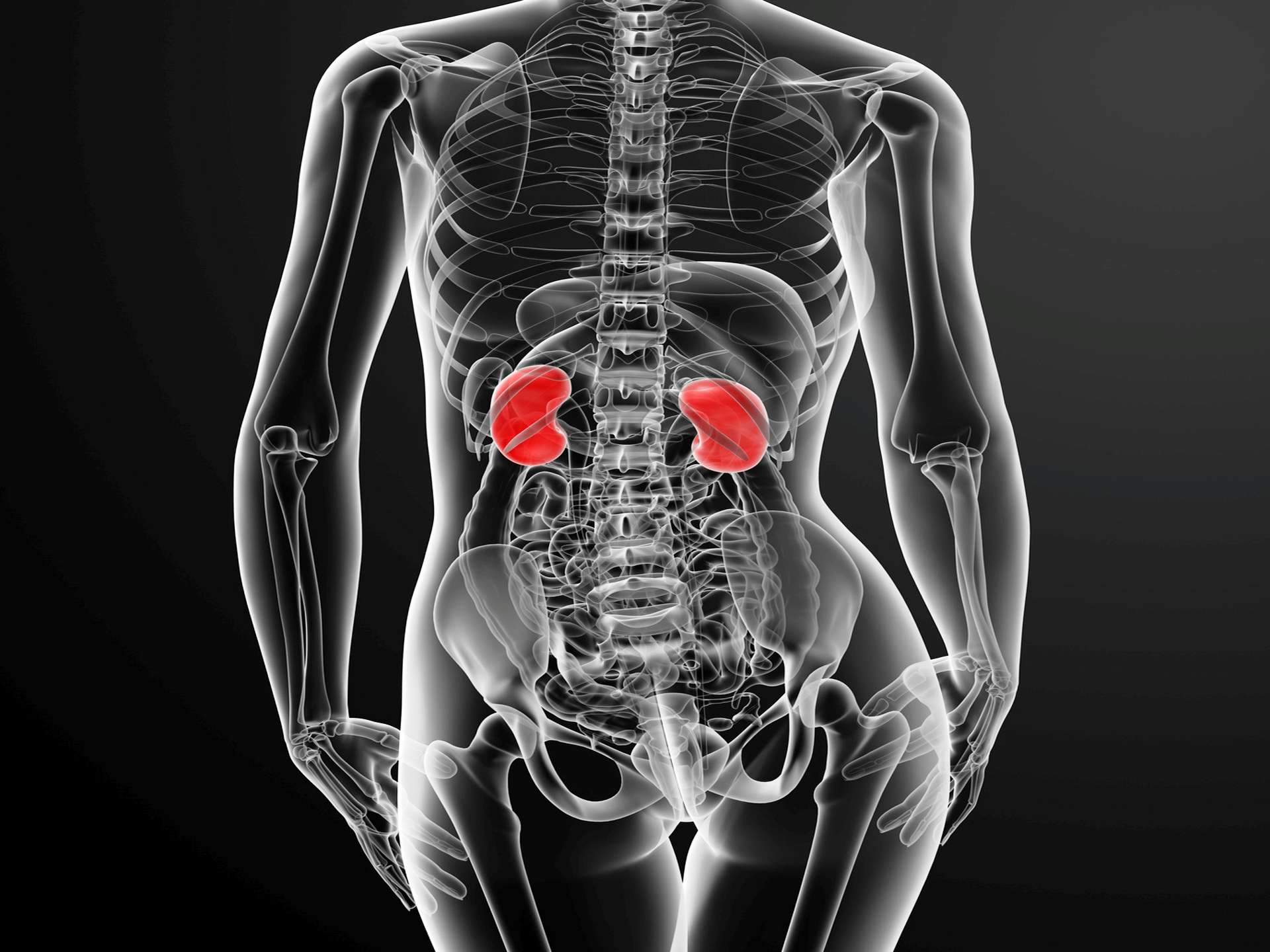 Bladder stones