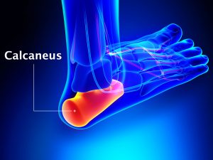 CALCANEUS