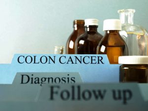 Colon cancer