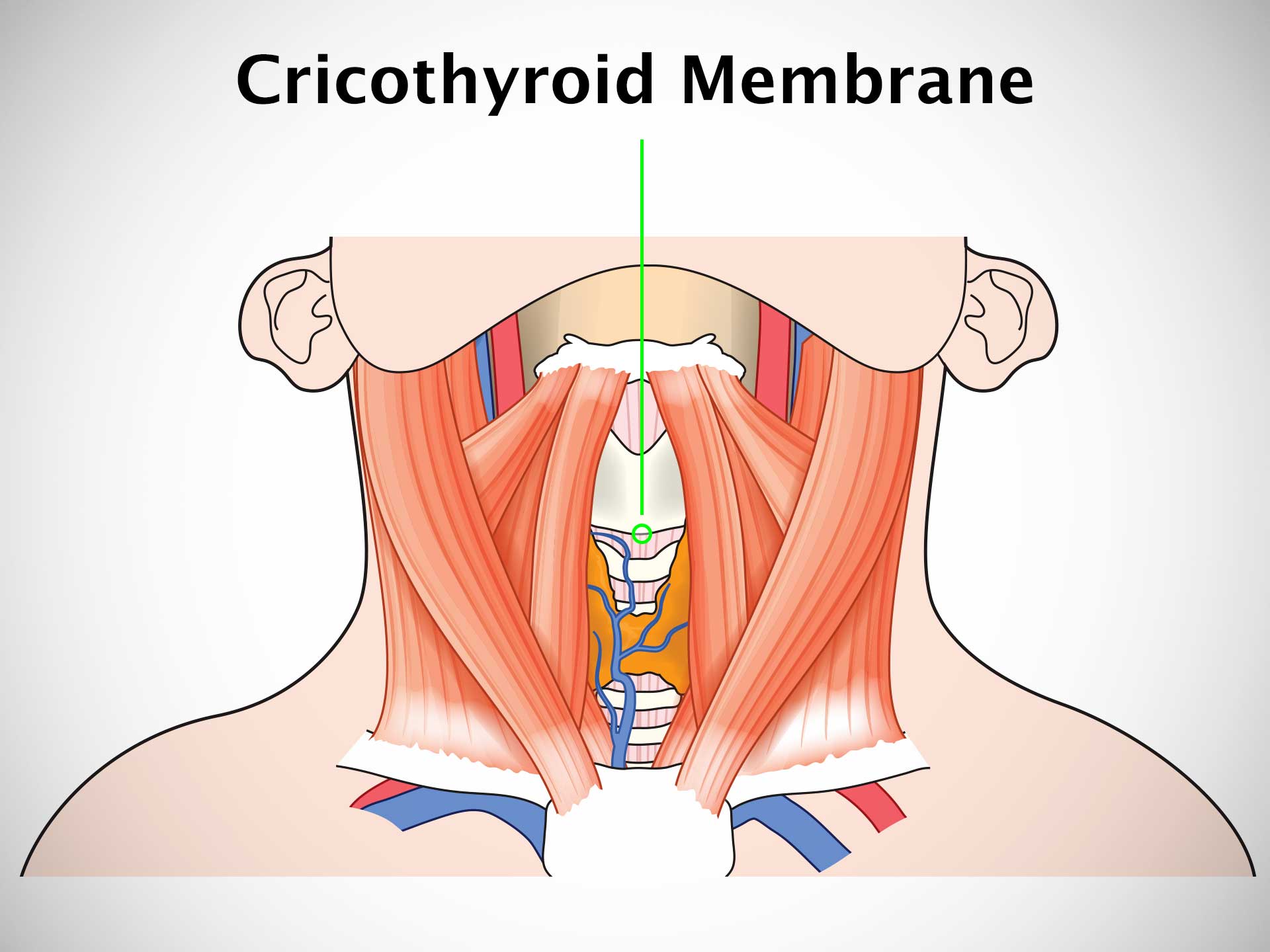 CRICOTHYROID