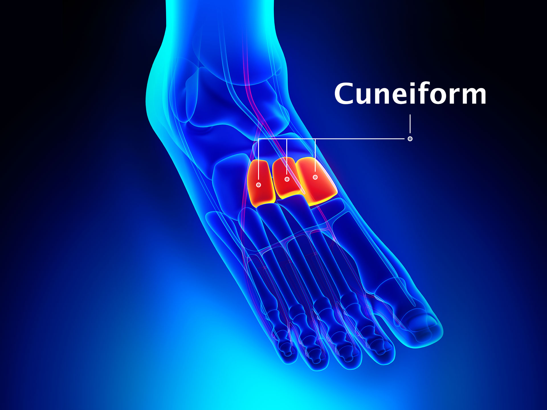 CUNEIFORM