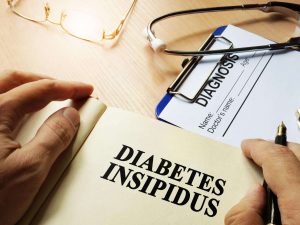 Diabetes insipidus