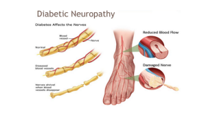 Diabetic neuropathy