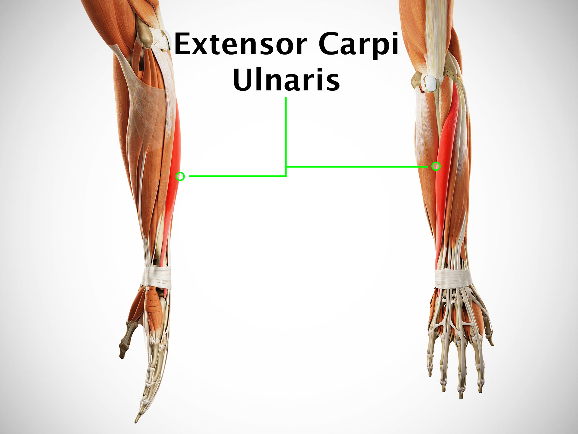 EXTENSOR CARPI ULNARIS