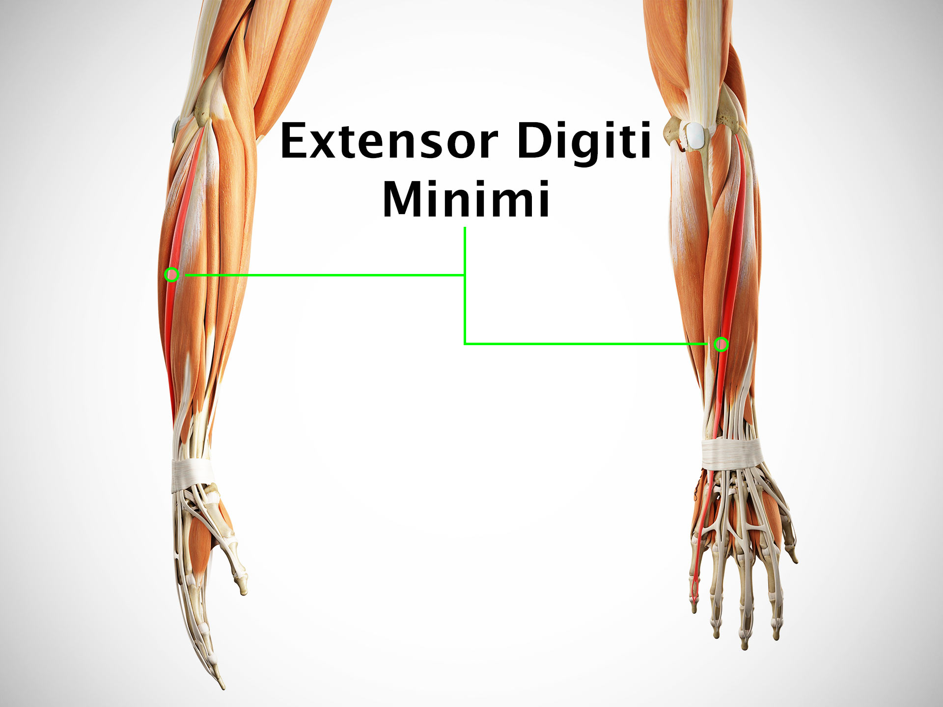 EXTENSOR DIGITI MINIMI