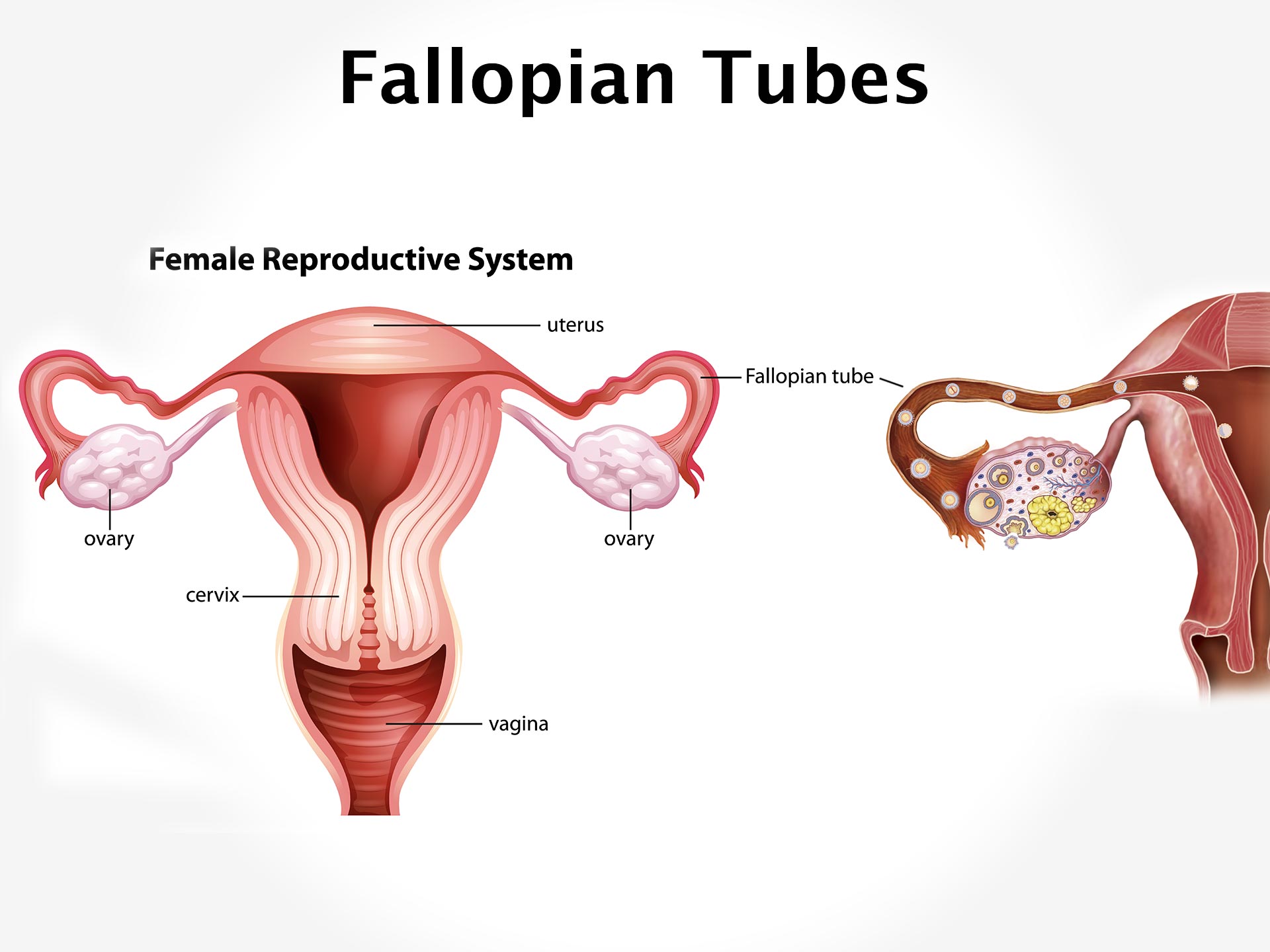 FALLOPIAN TUBES