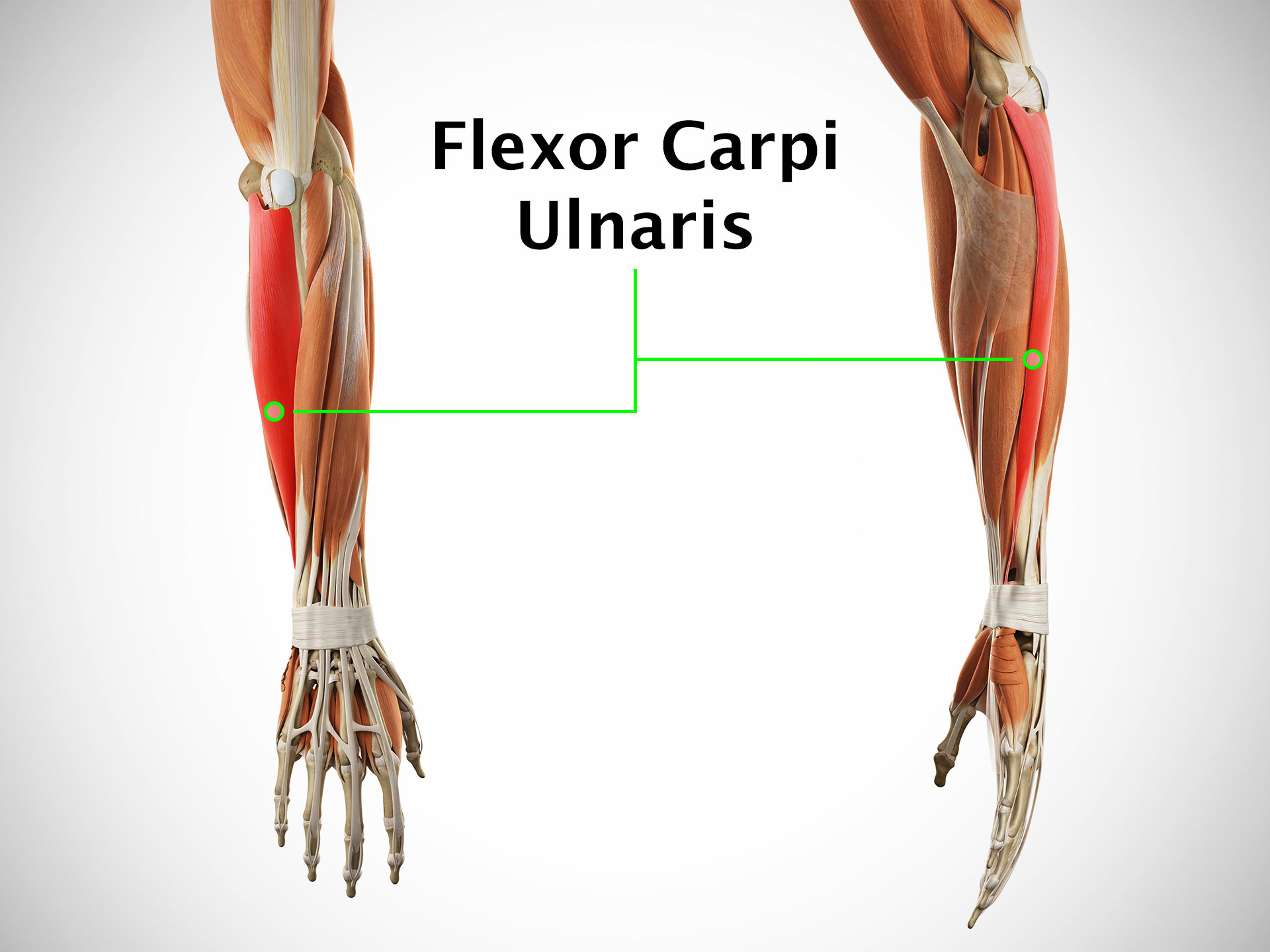 FLEXOR CARPI ULNARIS