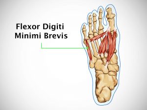 FLEXOR DIGITI MINIMI BREVIS