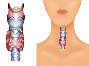 Hypothyroidism