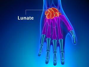 LUNATE