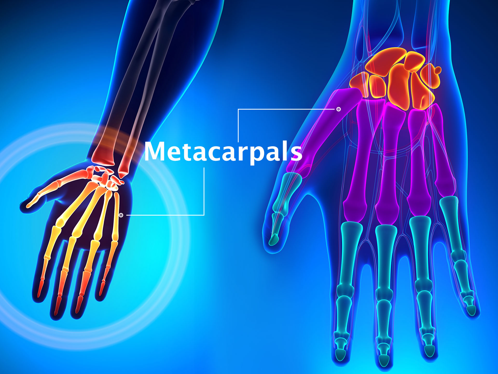 METACARPALS