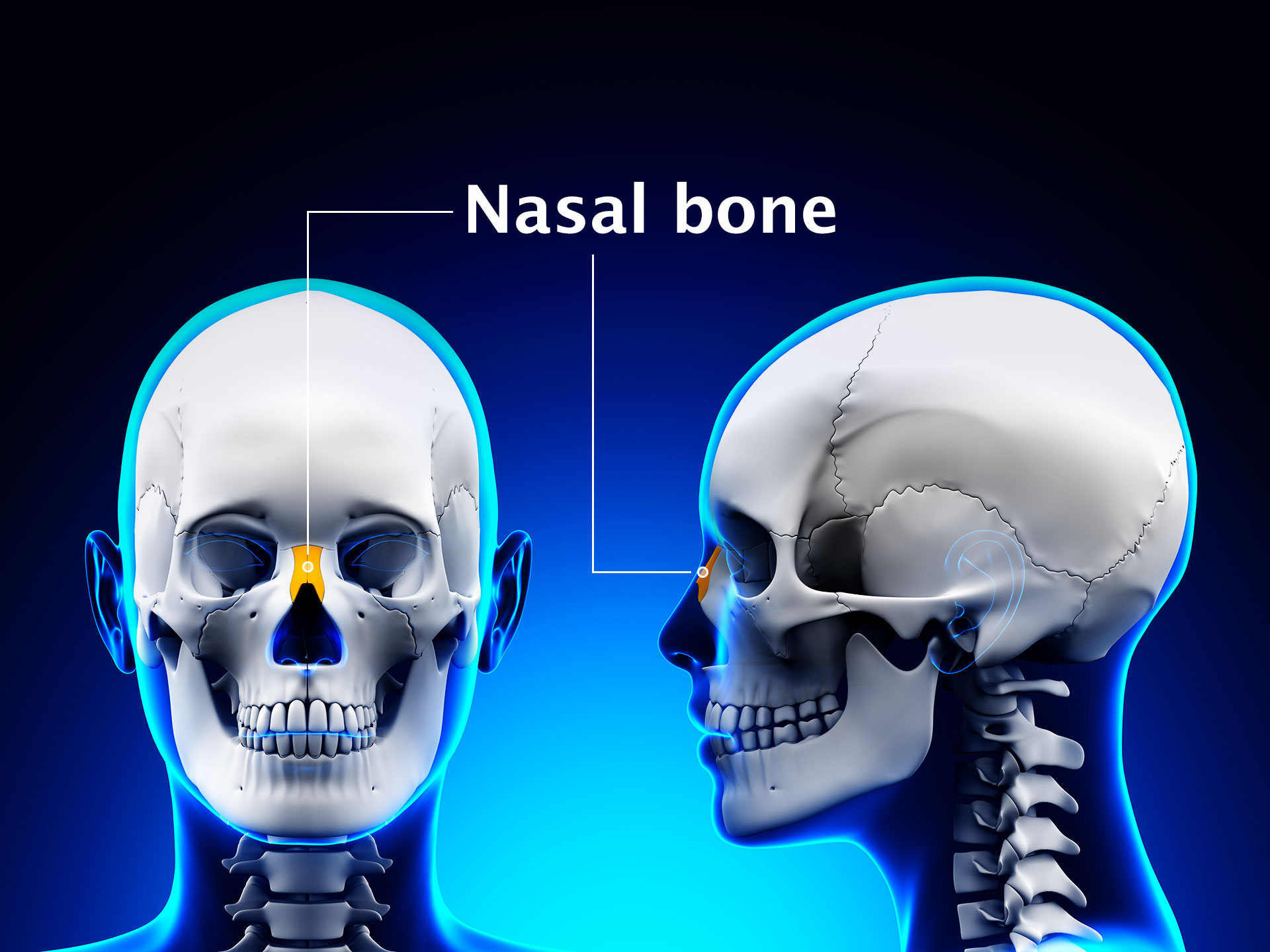 NASAL BONE