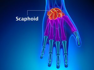 SCAPHOID