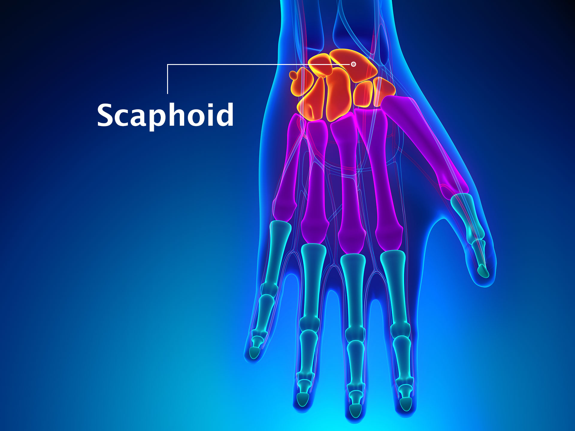 SCAPHOID