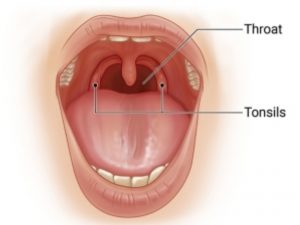 THROAT