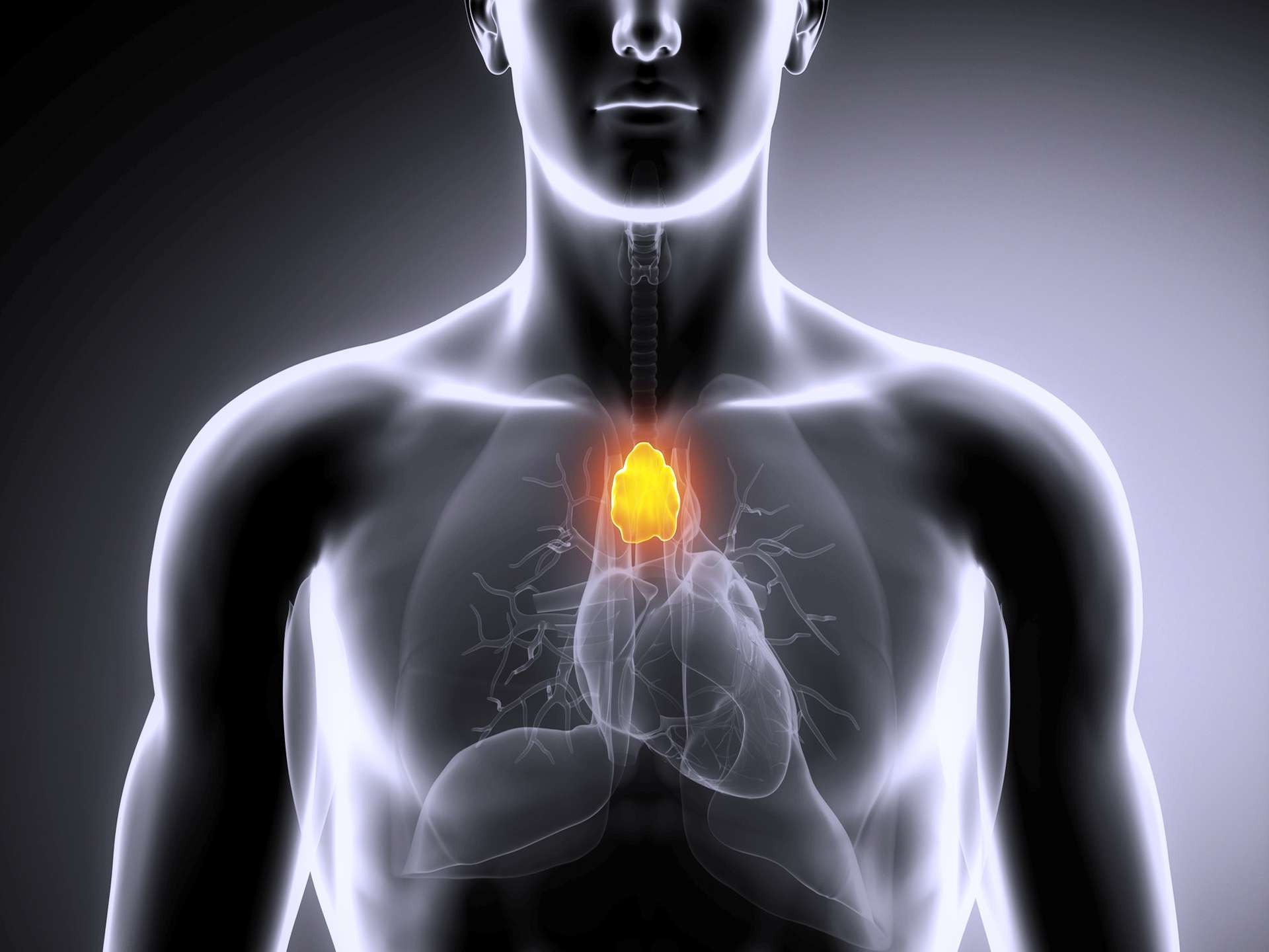Thymus cancer