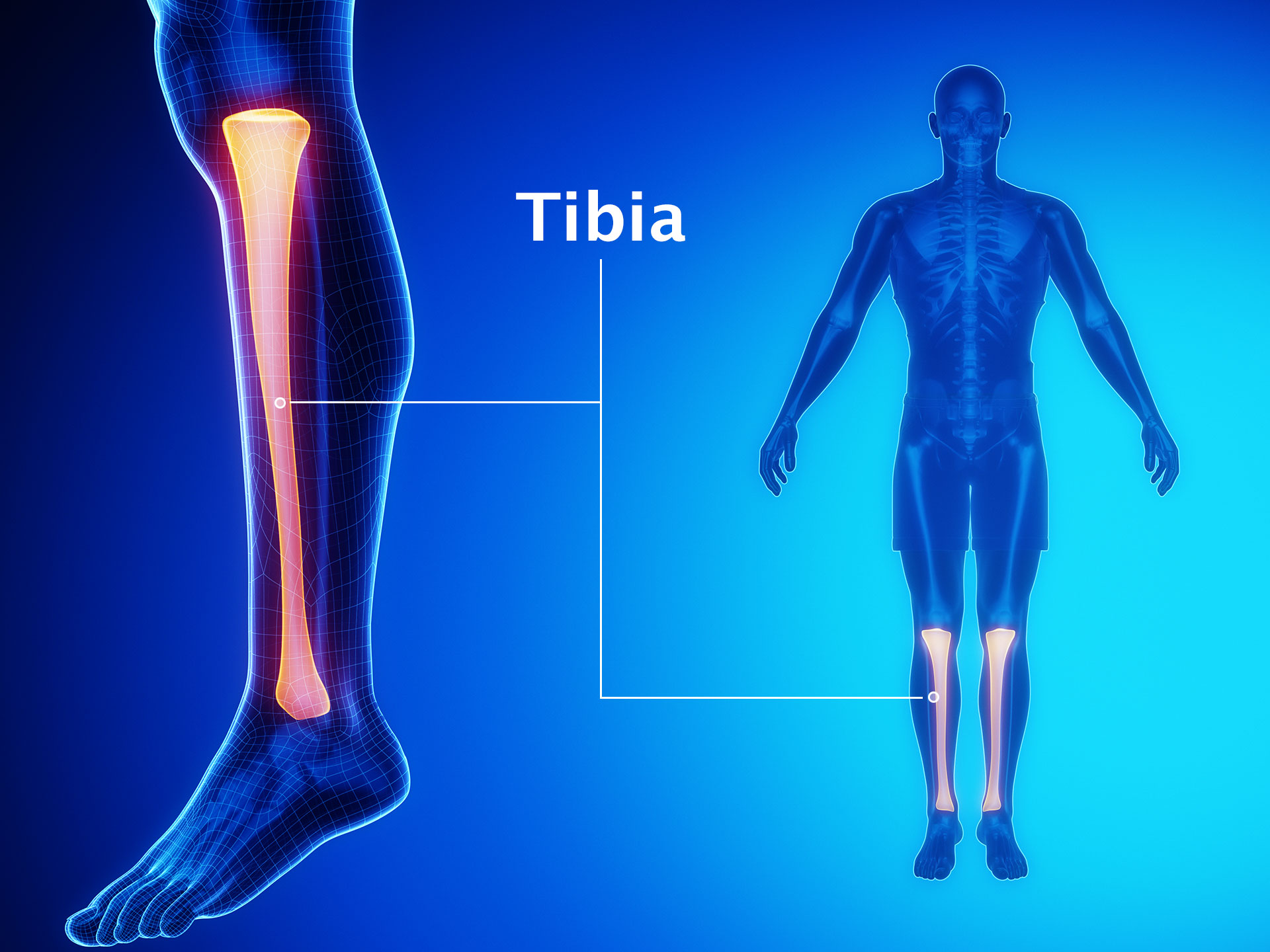 TIBIA