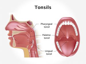 TONSILS