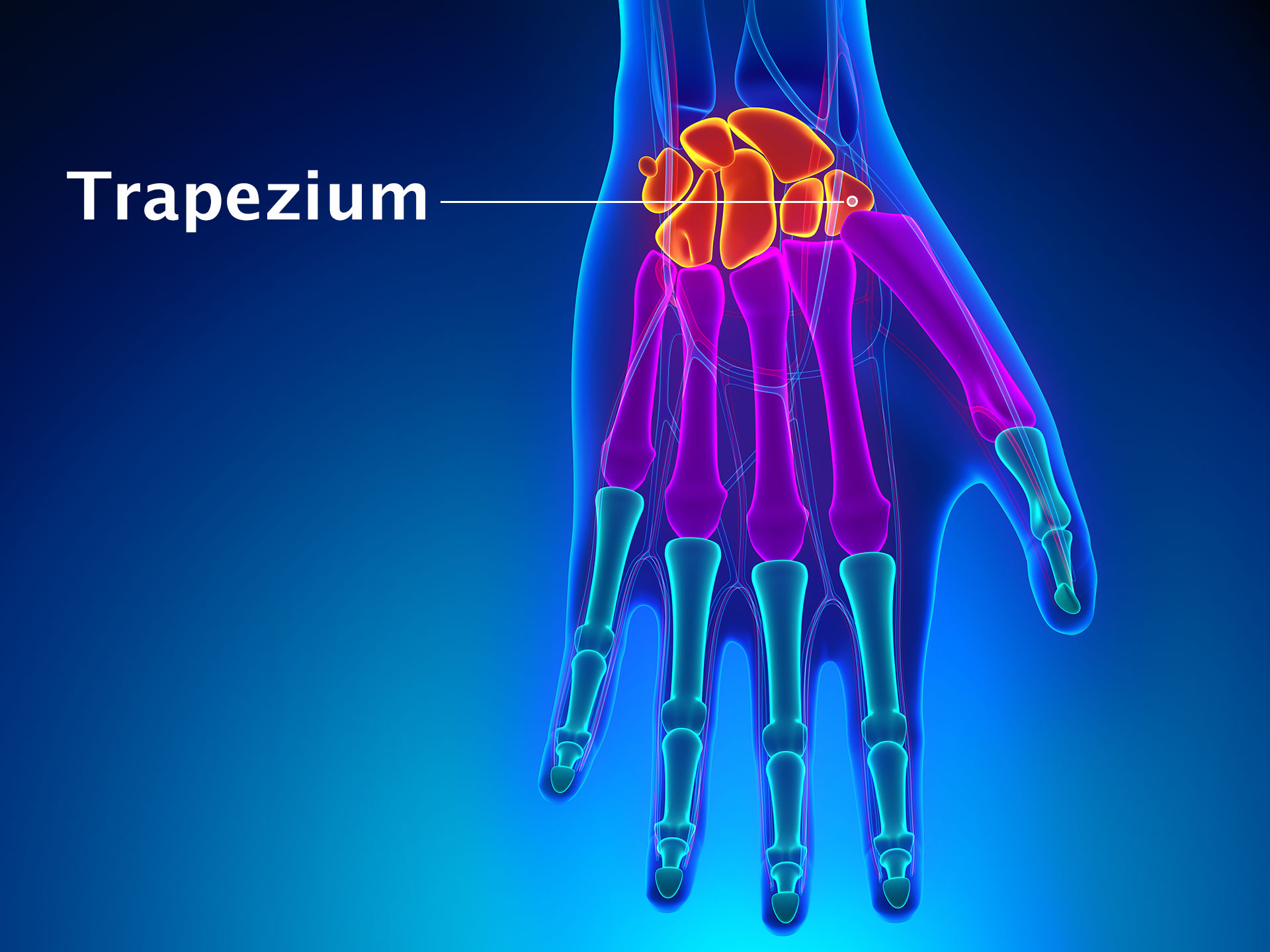 TRAPEZIUM